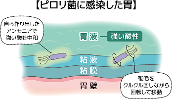 ピロリ菌外来イラスト1