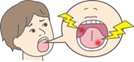 舌下免疫療法イラスト4