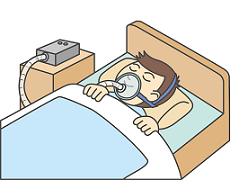 睡眠時無呼吸症候群「睡眠時無呼吸症候群の検査は･･･」画像